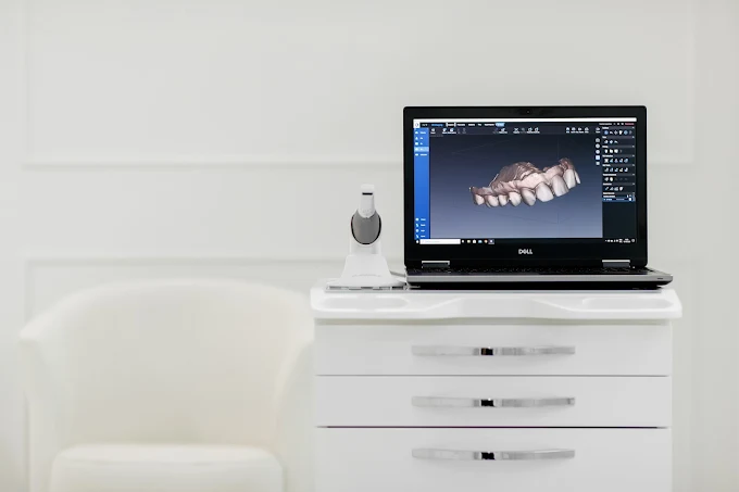 10. Scanner intraoral
